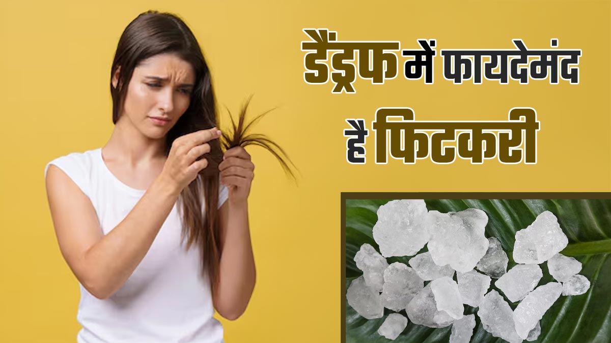 डैंड्रफ के लिए बेहद फायदेमंद है फिटकरी, जानें इस्तेमाल करने का तरीका