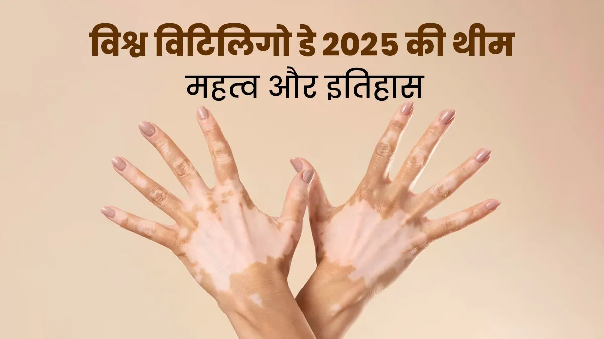 World Vitiligo Day 2025: क्यों मनाया जाता है वर्ल्ड विटिलिगो डे? जानें इस साल की थीम और महत्व