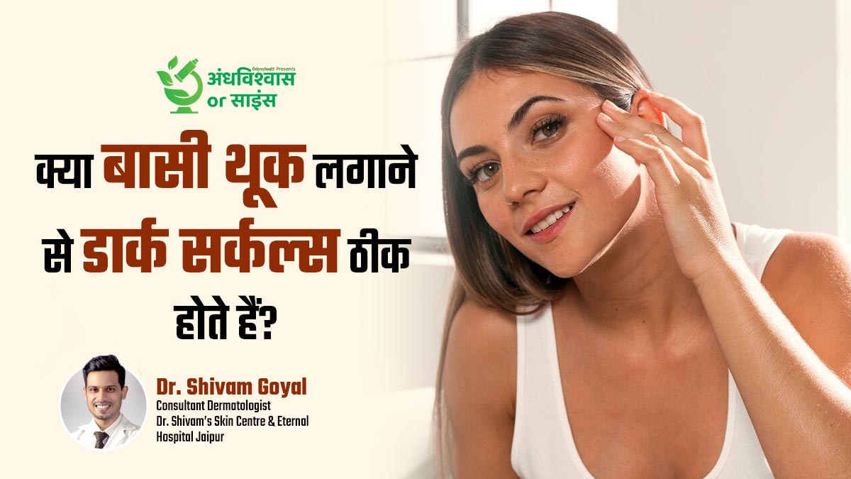 क्या बासी थूक लगाने से डार्क सर्कल्स ठीक होते हैं? डॉक्टर से जानें सच