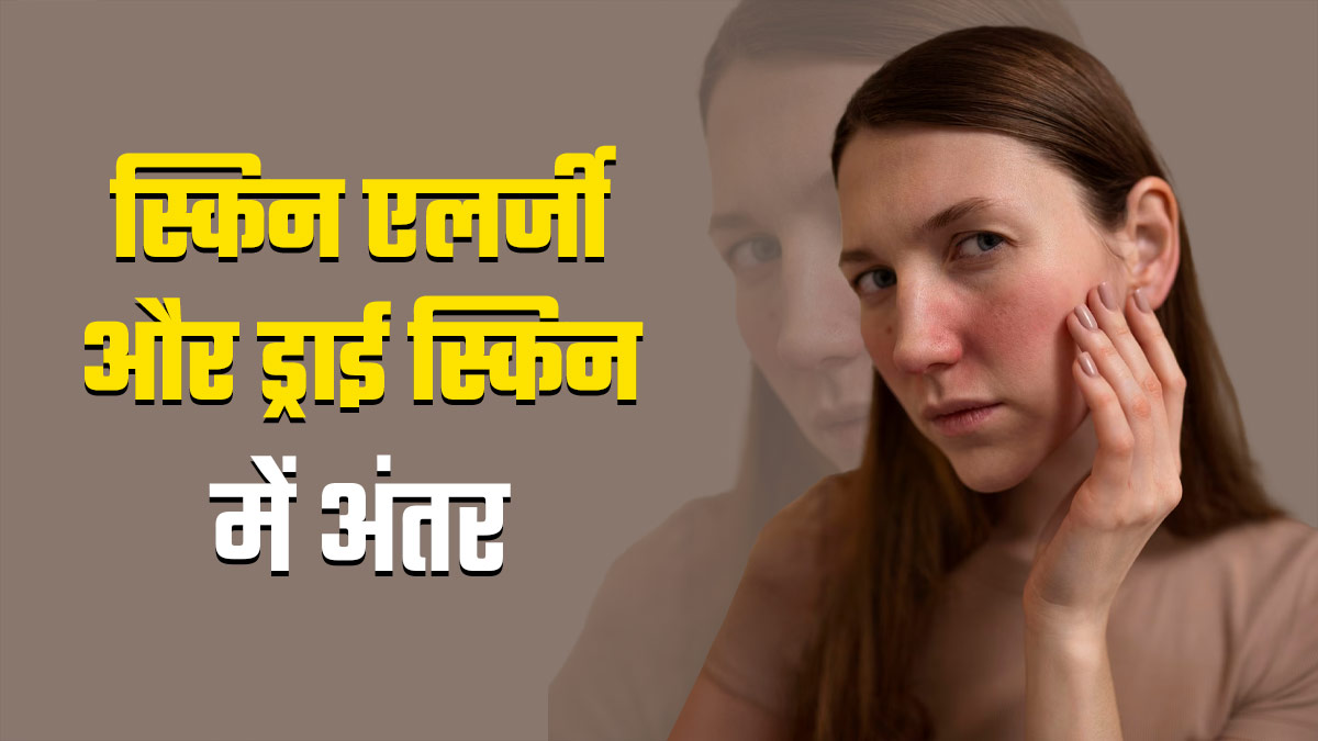 स्किन एलर्जी और ड्राई स्किन में अंतर कैसे समझें? डॉक्‍टर से जानें