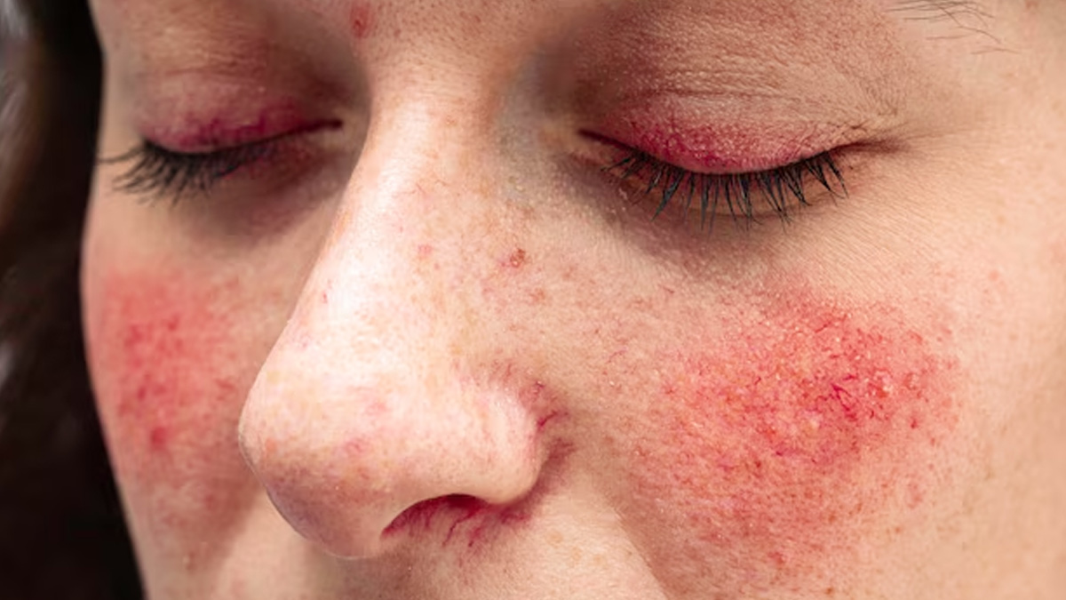 skin-allergy-and-dry-skin-difference