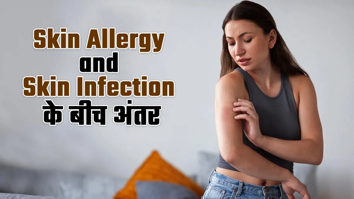 स्किन एलर्जी और स्किन इंफेक्शन के बीच क्या फर्क है? बता रहे हैं एक्सपर्ट