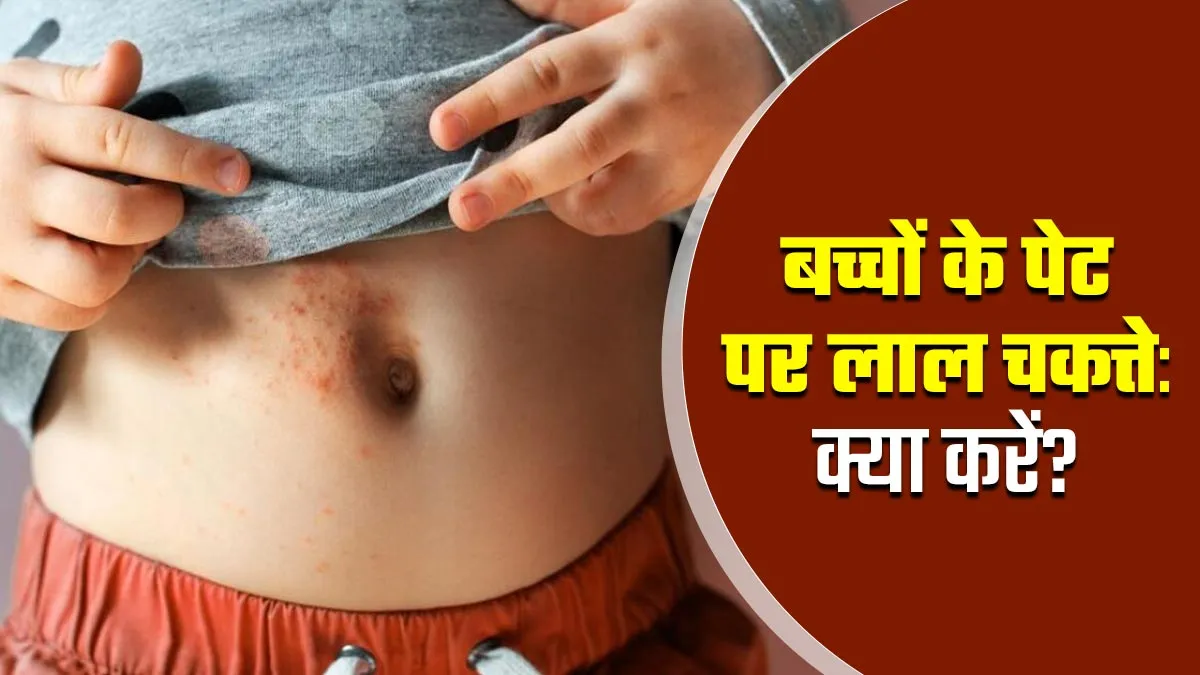 बच्‍चों के पेट पर लाल चकत्ते होने पर क्‍या करें? डॉक्‍टर से जानें