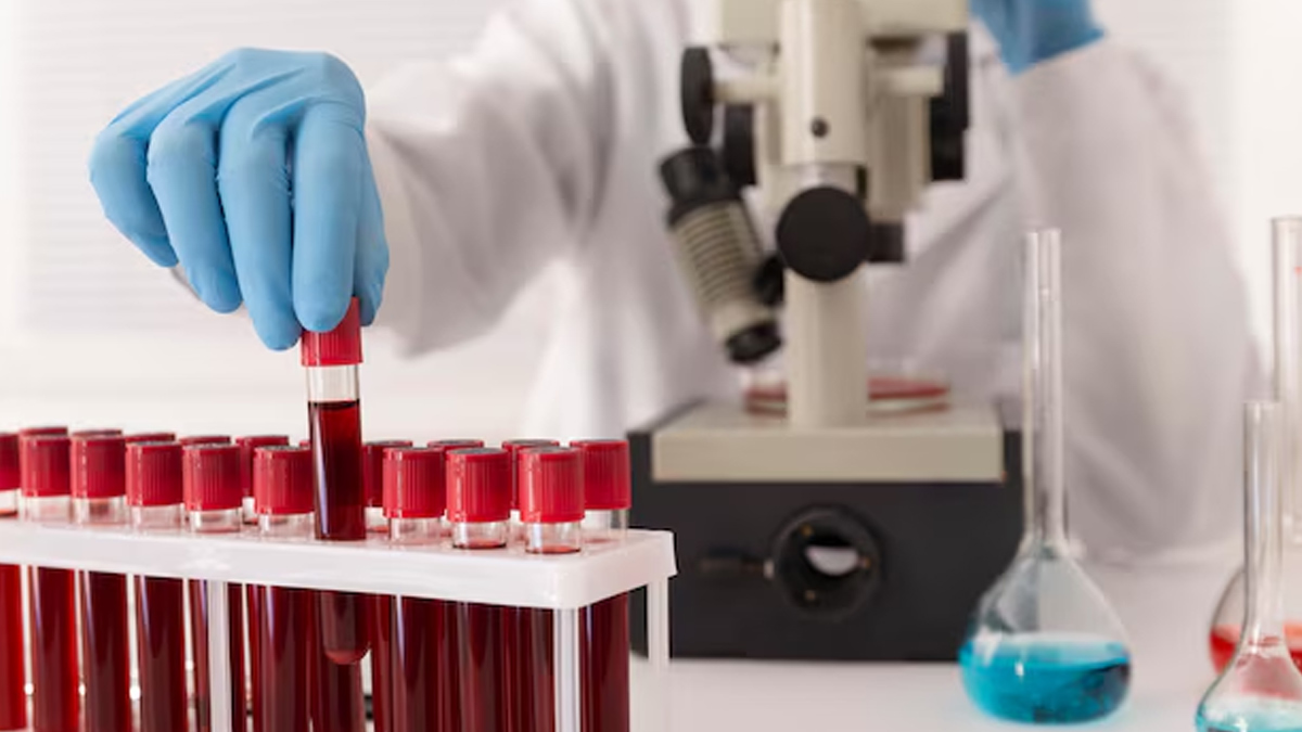Important medical tests for men above 50 in