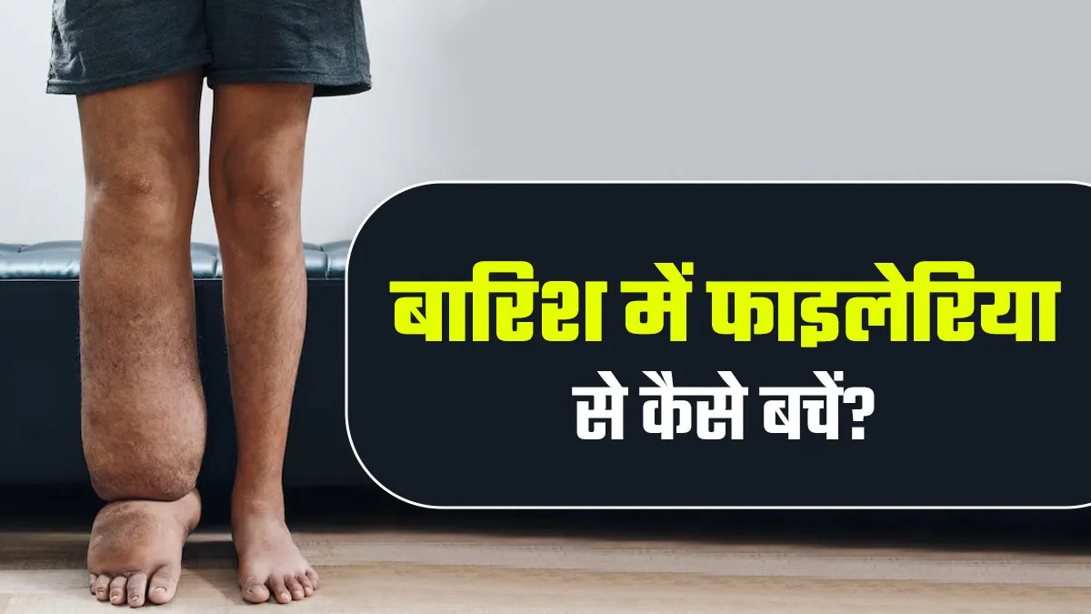 बार‍िश में फाइलेरिया से खुद की सुरक्षा कैसे करें? डॉक्‍टर से जानें