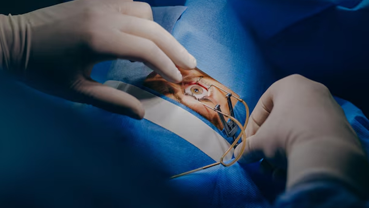 cataract-surgery-in-hindi