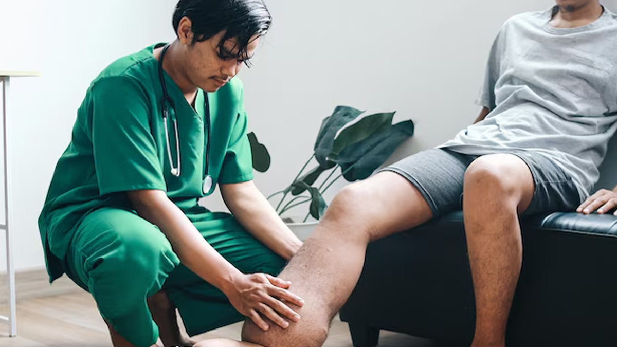 filariasis-prevention-in-rainy-days