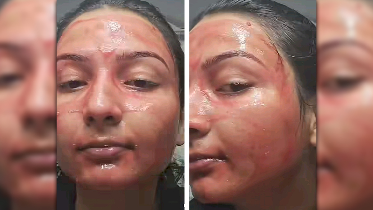 skin-care-true-story