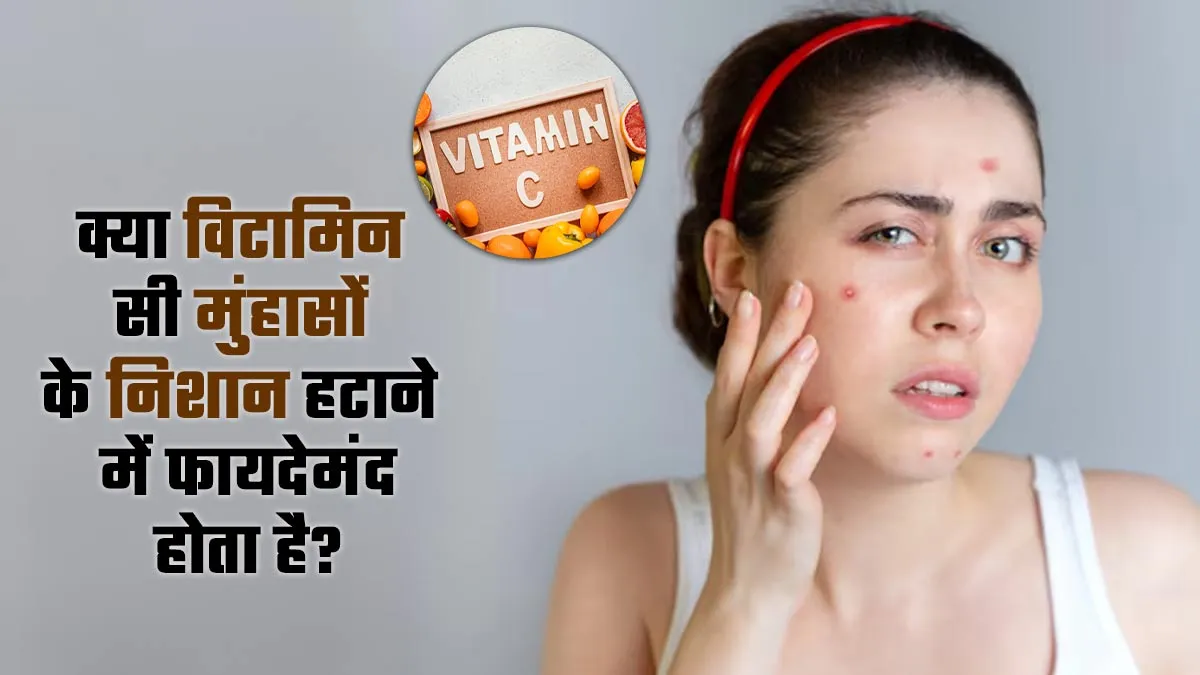 क्या विटामिन सी मुंहासों के निशान हटाने में फायदेमंद होता है? जानें इसके नेचुरल सोर्स के बारे में