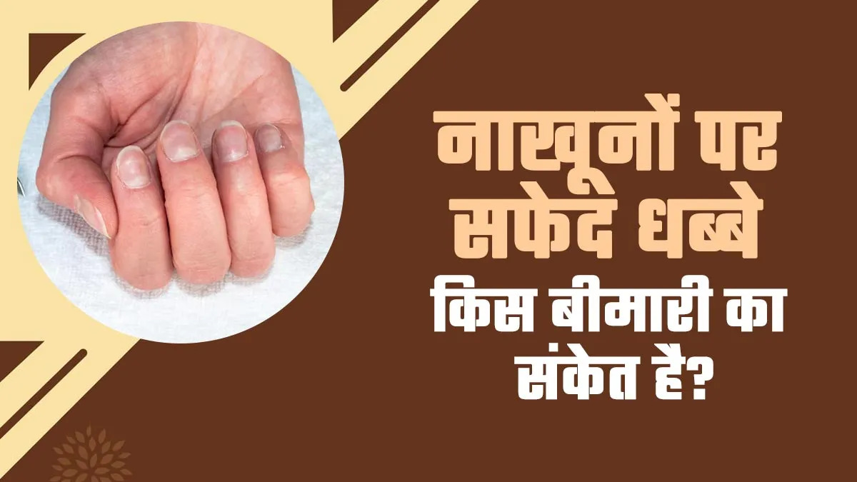 नाखूनों पर सफेद धब्बे पड़ना किस बीमारी का संकेत है? डॉक्टर से जानें