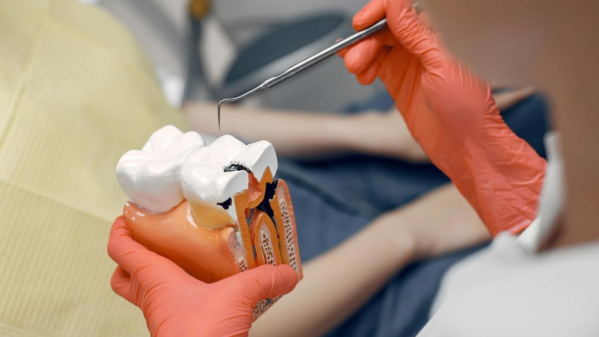 fluoride treatments for dental health i