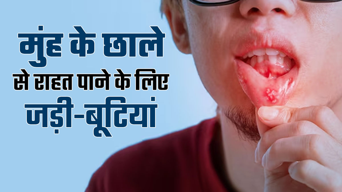 मुंह में छालों की समस्या से हैं परेशान तो पिएं नीम, बबूल और बरगद की छाल का ये काढ़ा, मिलेगी राहत