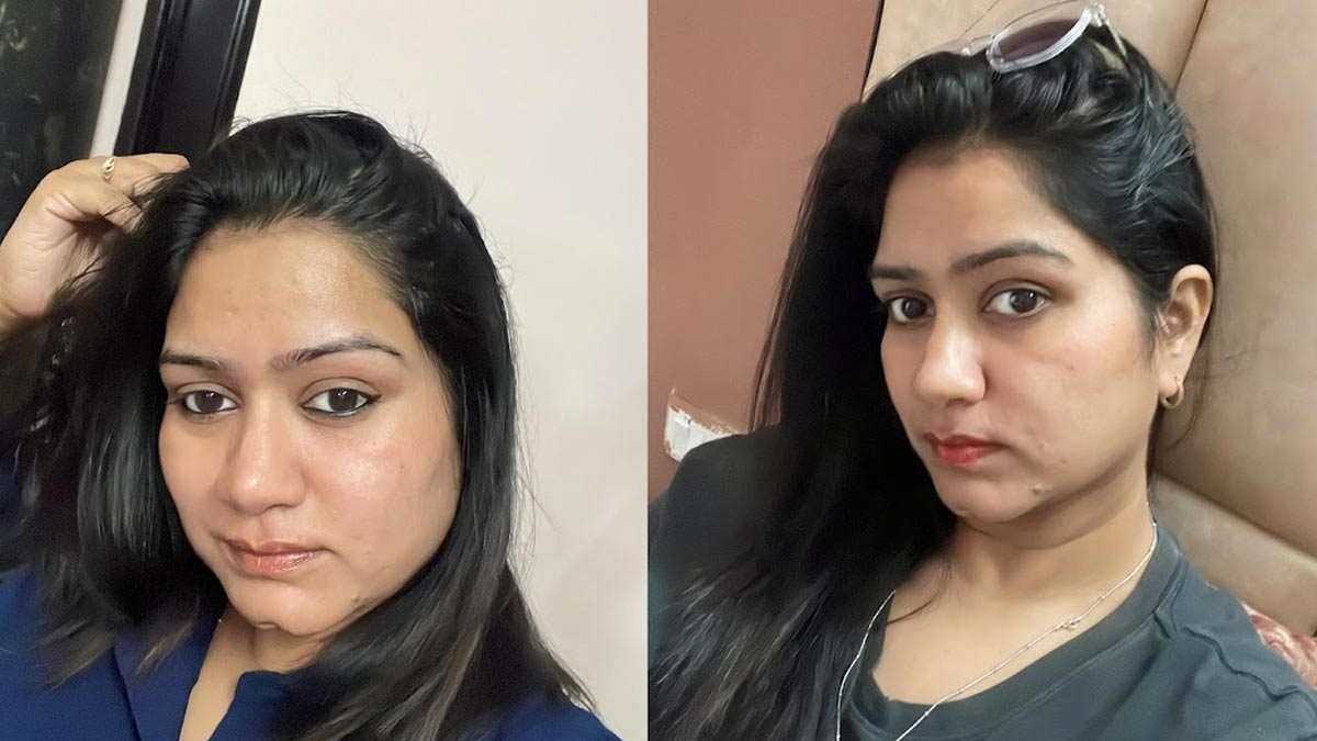 Weight loss fat loss transformation mitali jain 001