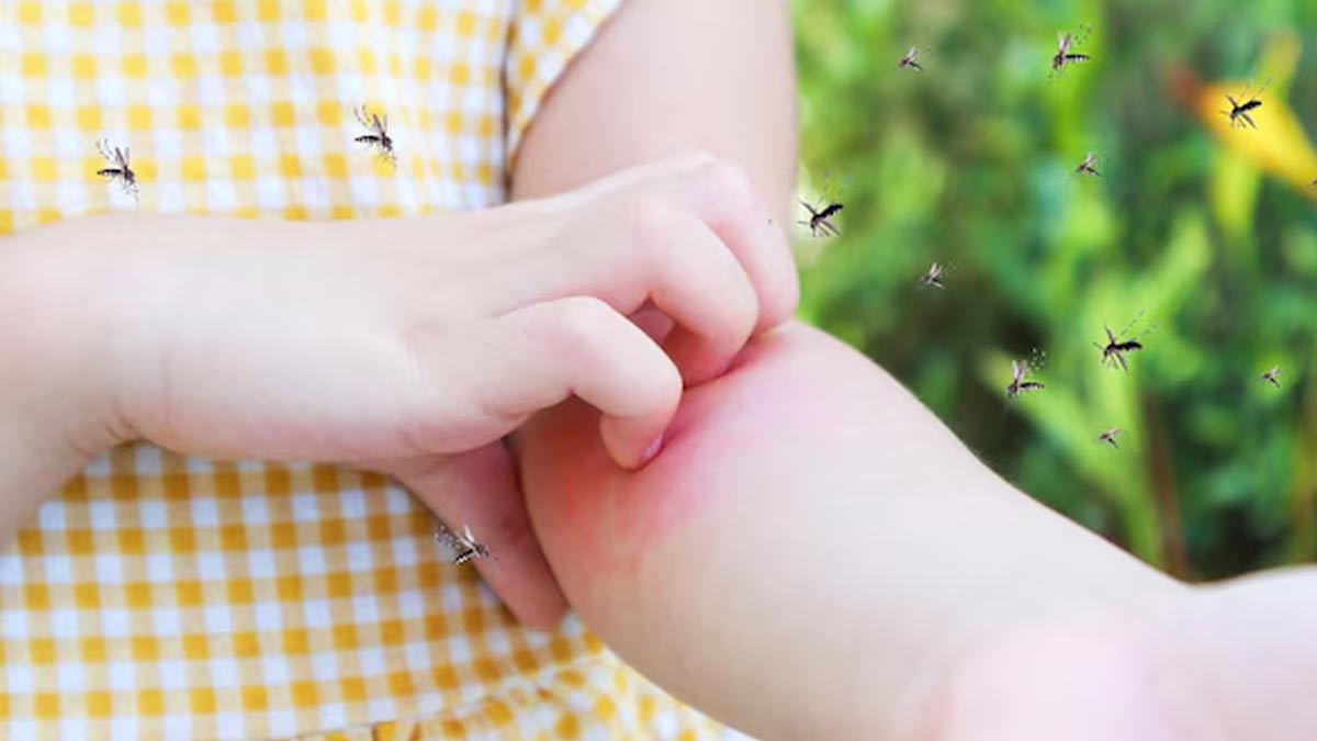 why does a mosquito bite itch so much