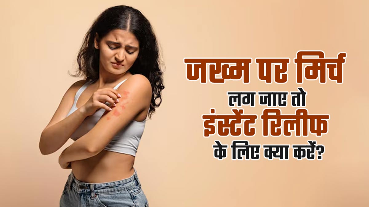 जख्म पर मिर्च लग जाए तो इंस्टेंट रिलीफ के लिए अपनाएं ये 5 तरीके, तुरंत जलन होगी कम