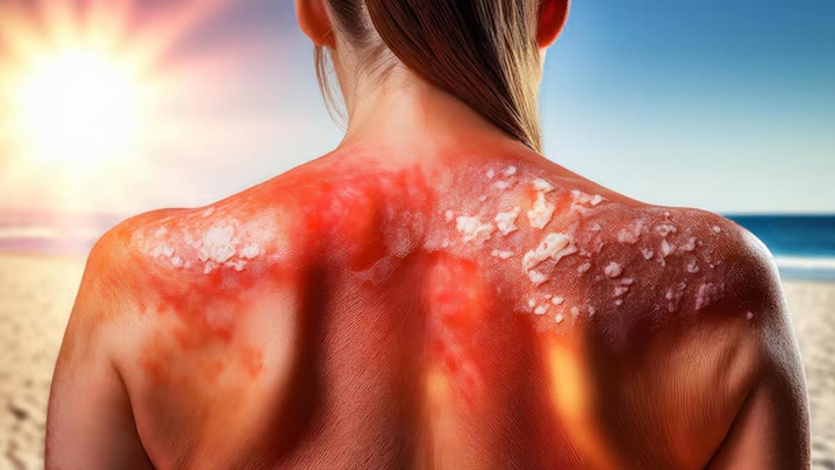 cooked rice water benefits for skin-inside