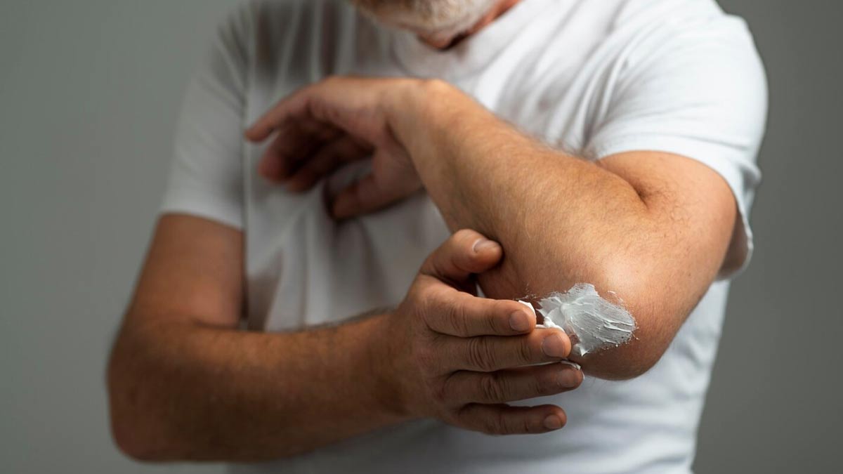 tips to get instant relief for chilli burn on a wound 01 (9)