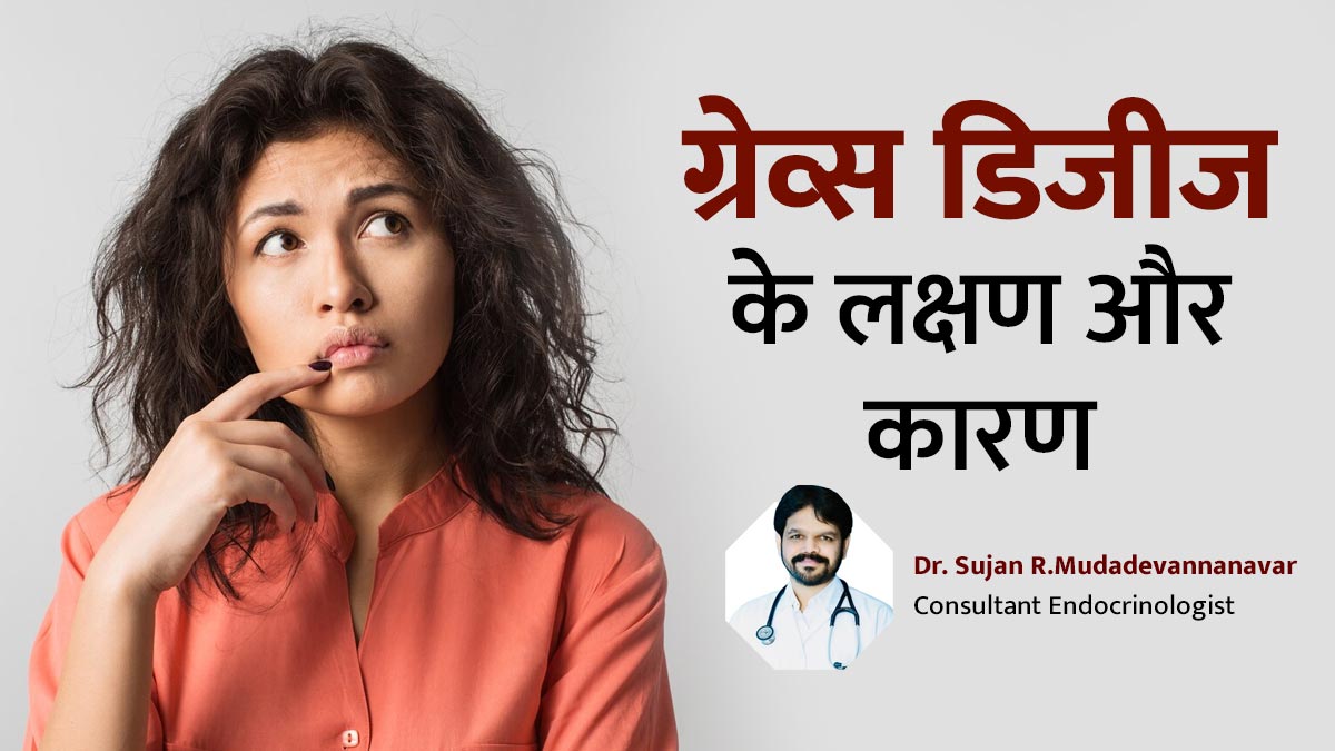 ग्रेव्स डिजीज: हांथों में कंपन के साथ पसीने से तर-बतर हो जाता है शरीर, जानें इस गंभीर बीमारी का कारण