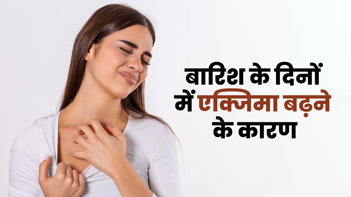बारिश के दिनों में एक्जिमा क्यों बढ़ जाता है? डॉक्टर से जानें इसके कारण
