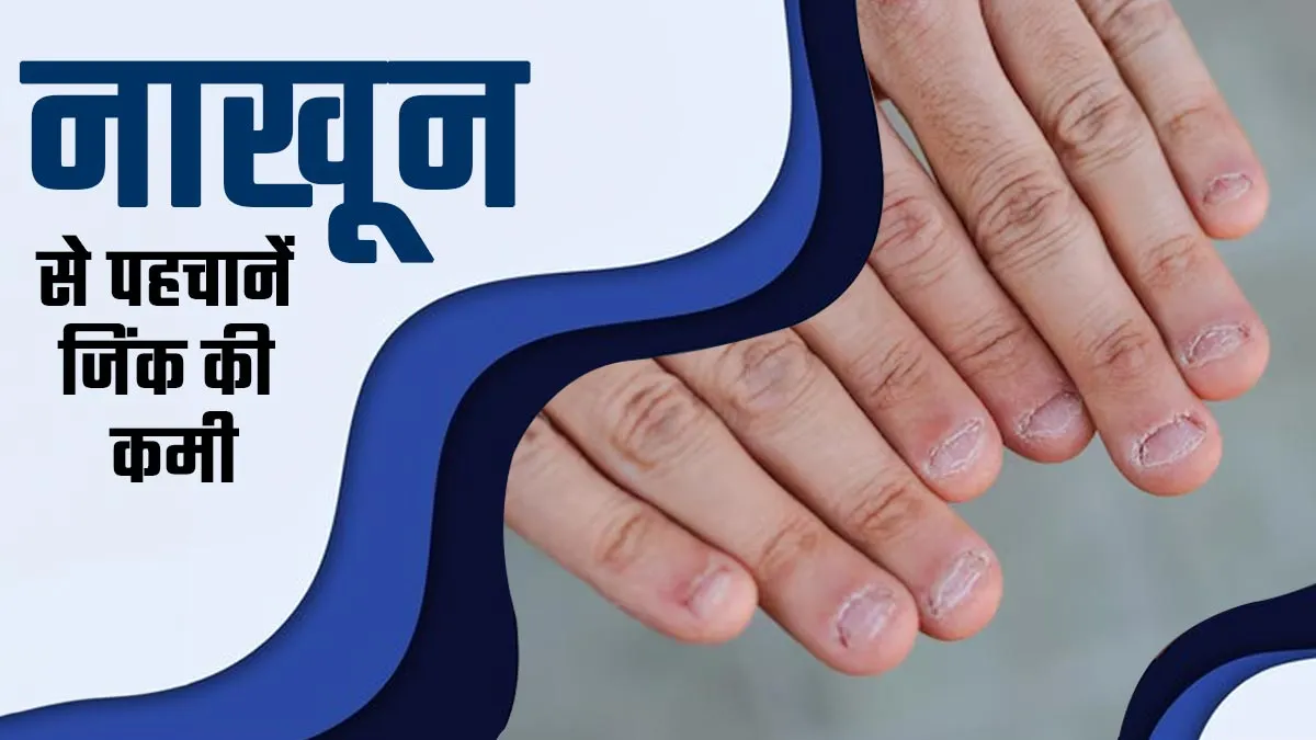 नाखून देखकर पहचानें शरीर में जिंक की कमी, एक्सपर्ट ने बताया किन संकेतों को नजरअंदाज न करें