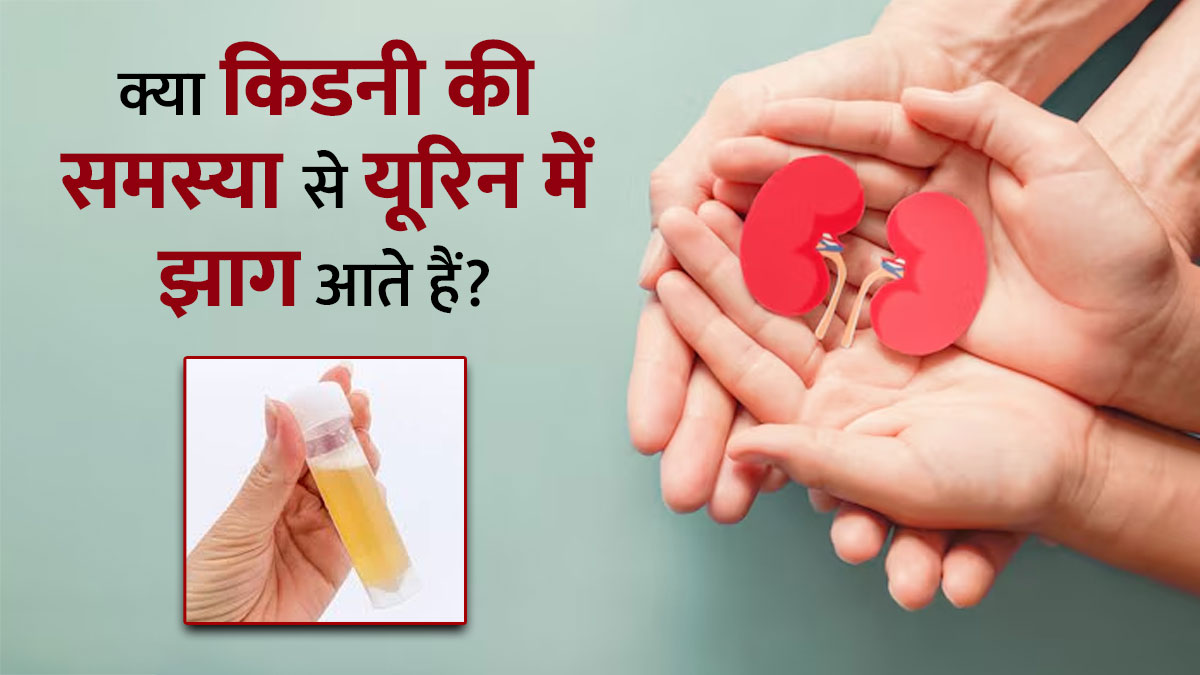 आपके यूरिन में भी आते हैं झाग? हो सकते हैं इस अंग से जुड़ी गंभीर समस्या के संकेत