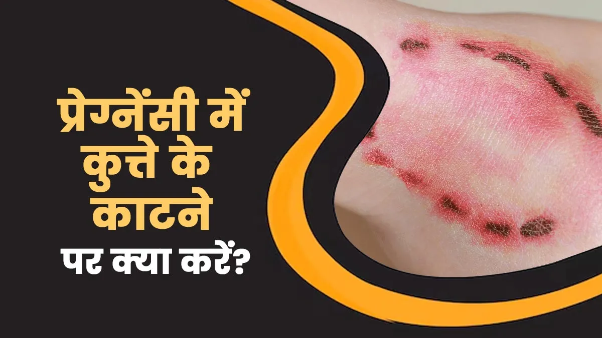 प्रेग्नेंसी में कुत्ते के काटने पर क्या करें? जानें डॉक्टर की राय और रेबीज से जुड़ी सावधानियां