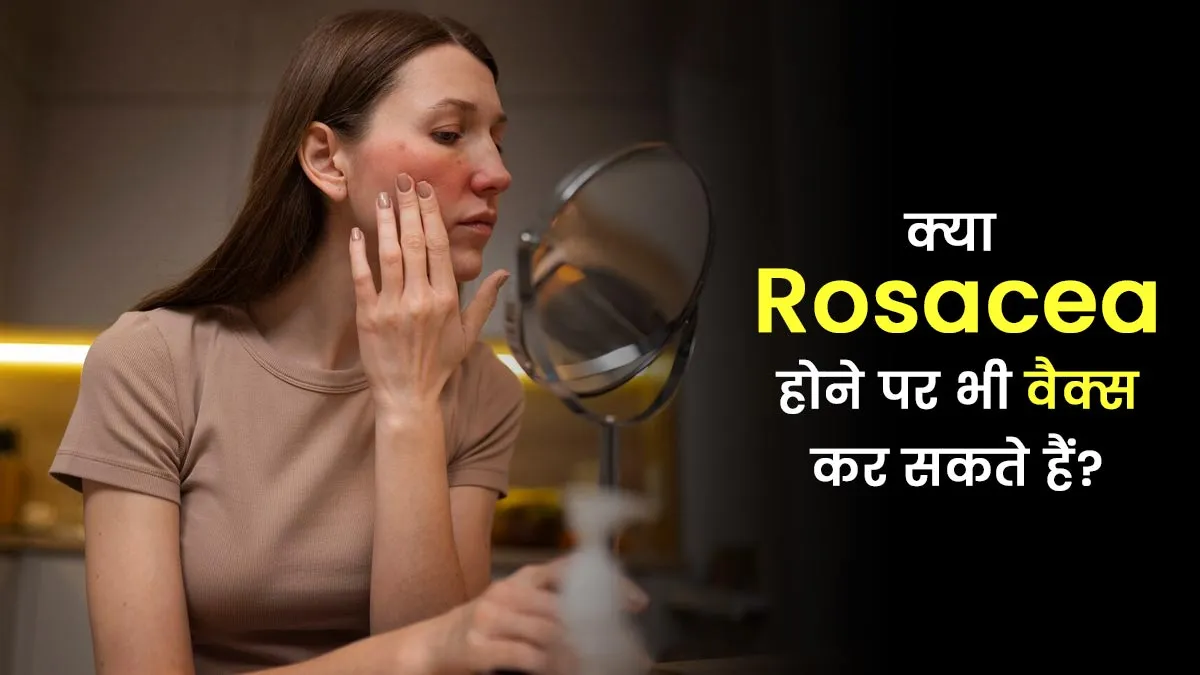 क्या चेहरे पर रोजेशिया (Rosacea) होने के बावजूद वैक्स करवा सकते हैं? एक्सपर्ट बता रहे हैं सच्चाई