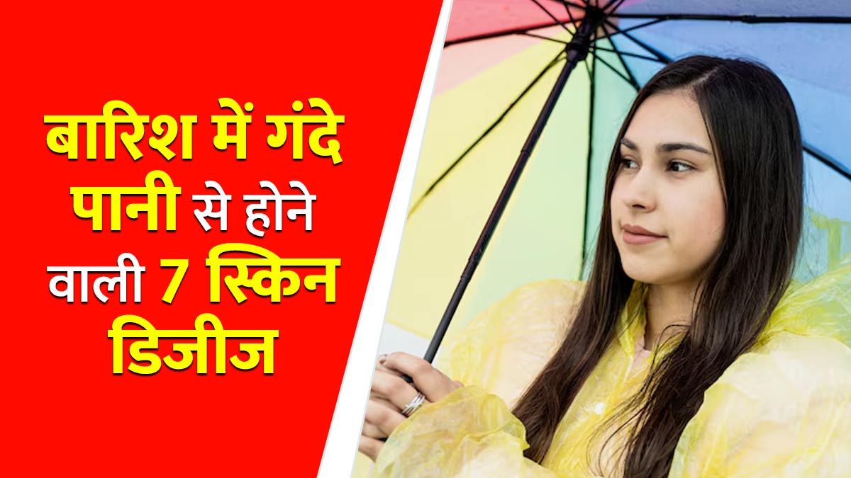बार‍िश में गंदे पानी के संपर्क से हो सकती हैं ये 7 स्‍क‍िन ड‍िजीज, डॉक्‍टर से जानें बचाव के उपाय