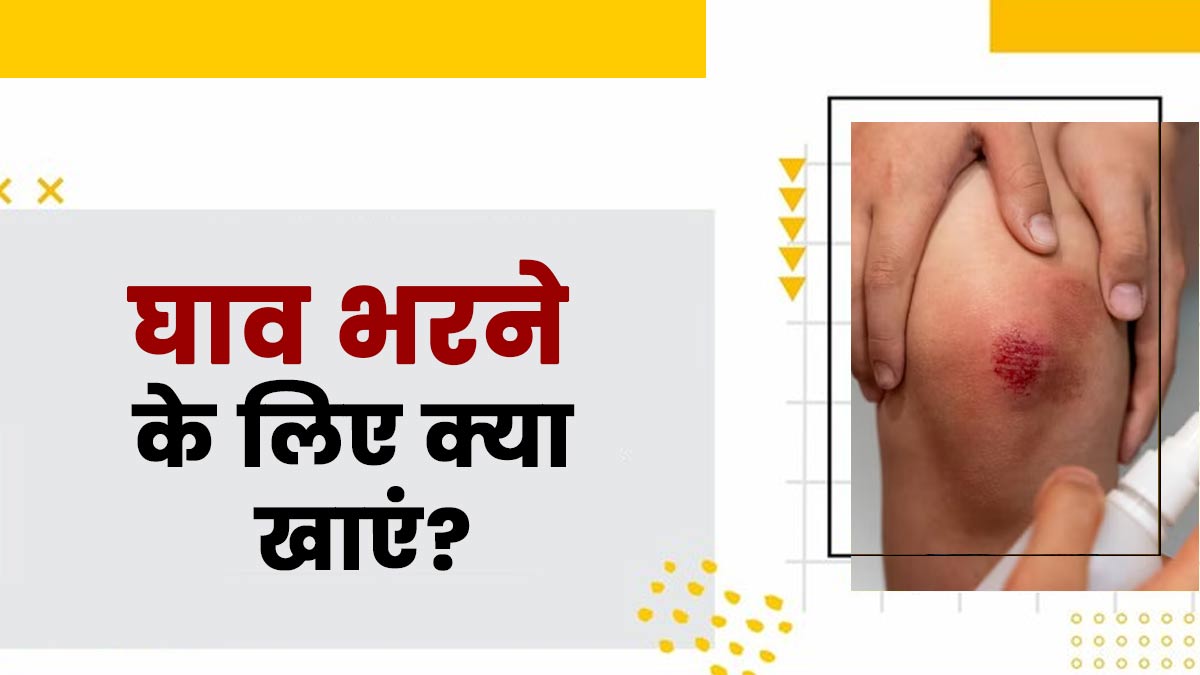 घाव को जल्दी भरने के लिए खाएं ये 7 चीजें, जल्दी होगी रिकवरी