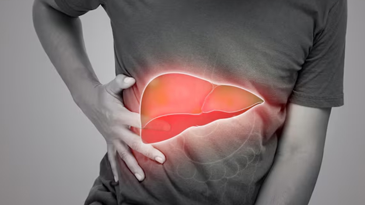 later stage symptoms of liver cirrhosis-03