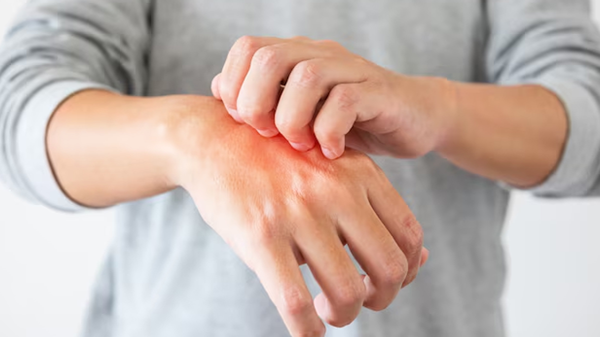 Habits That Increase The Risk Of Infection In Monsoon i