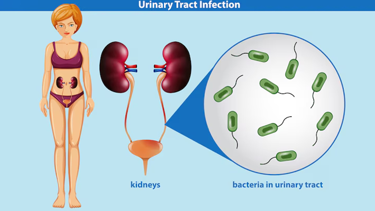 urine-infection-in-monsoon