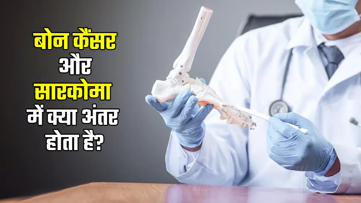 बोन कैंसर और सारकोमा में क्या अंतर होता है? समझें सरल भाषा में