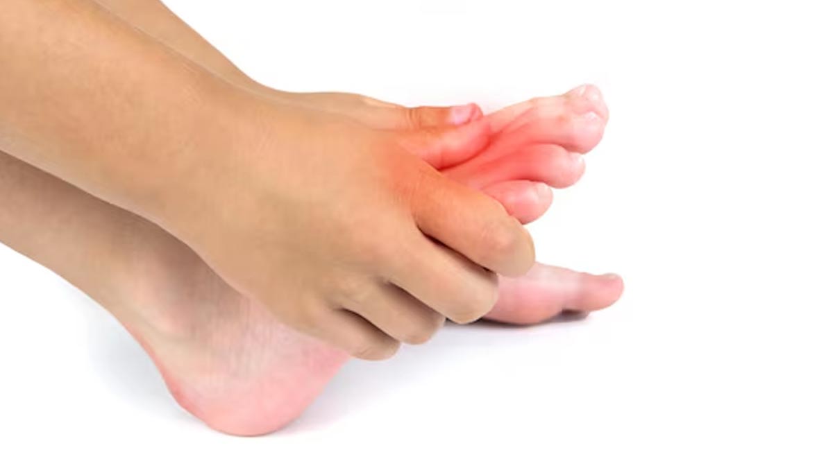 does rainy weather affect gout in hindi 01 (3)
