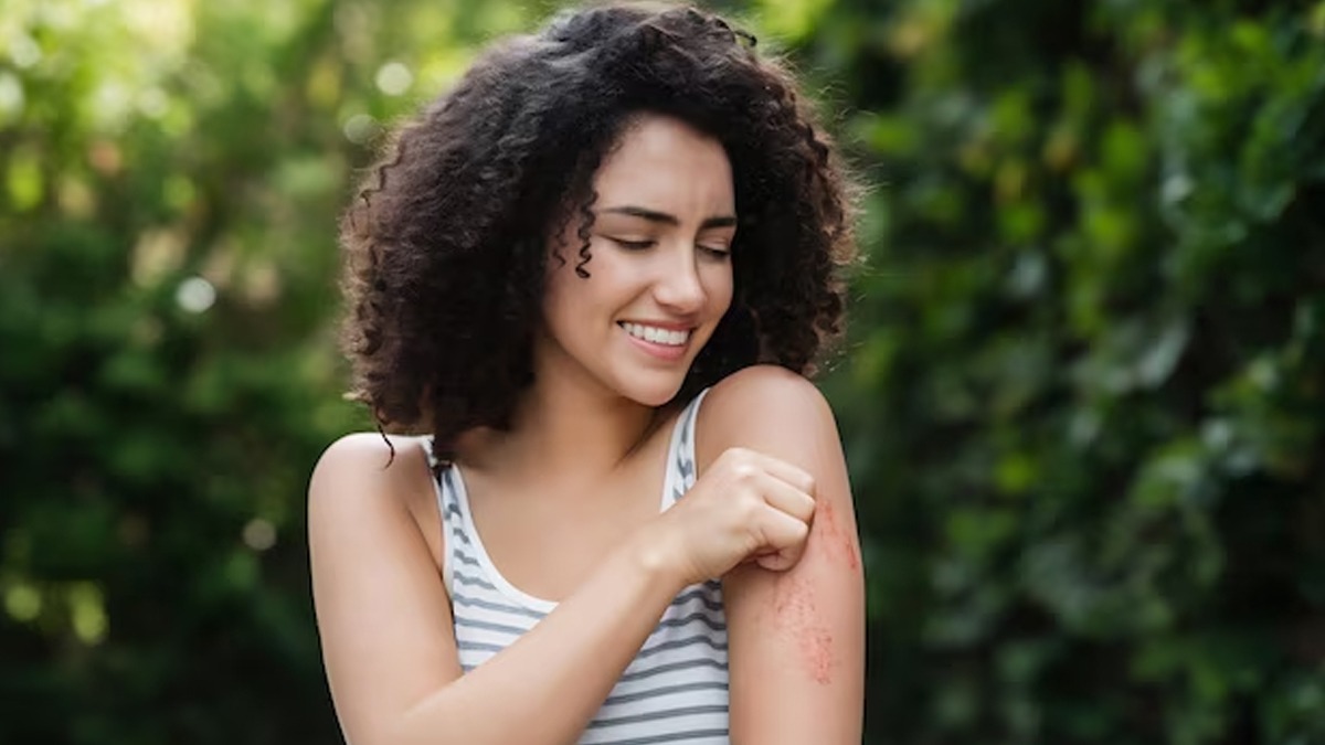 एलर्जी किसकी कमी से होती है | allergy kiski kami se hoti hai skin-itching-inside