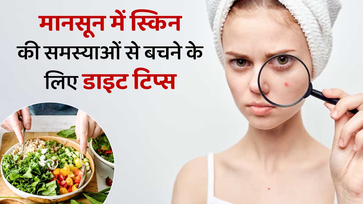 मानसून में एक्ने और ऑयली स्किन से बचने के लिए डाइट में करें ये 5 बदलाव, चेहरा रहेगा चमकदार