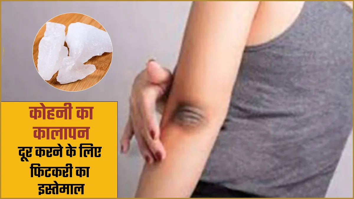कोहनी के कालेपन से हैं परेशान? त्वचा में निखार के लिए इस तरह करें फिटकरी का इस्तेमाल