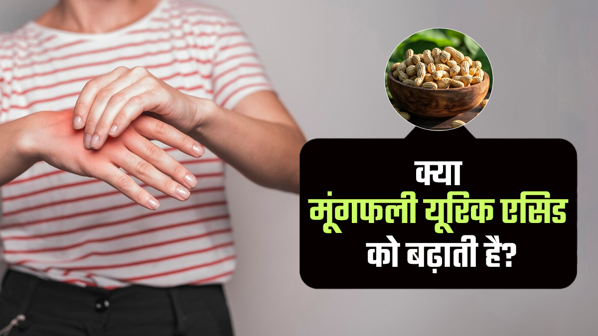 क्या मूंगफली खाने से बढ़ता है यूरिक एसिड? आयुर्वेदाचार्य से जानें