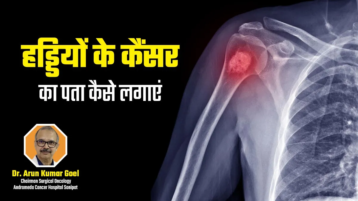 ऑन्कोलॉजिस्ट से जानिए- हड्डियों के कैंसर का जल्दी पता कैसे लगाएं?