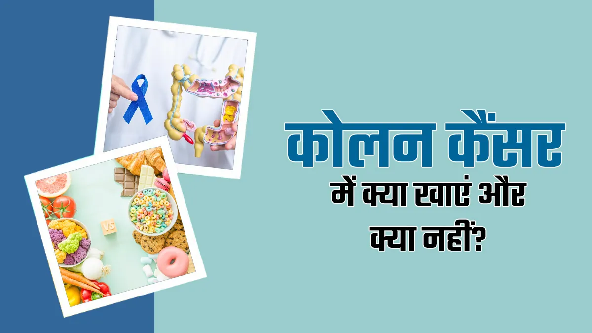 कोलन कैंसर में क्या खाएं और क्या नहीं? डॉक्टर से जानें