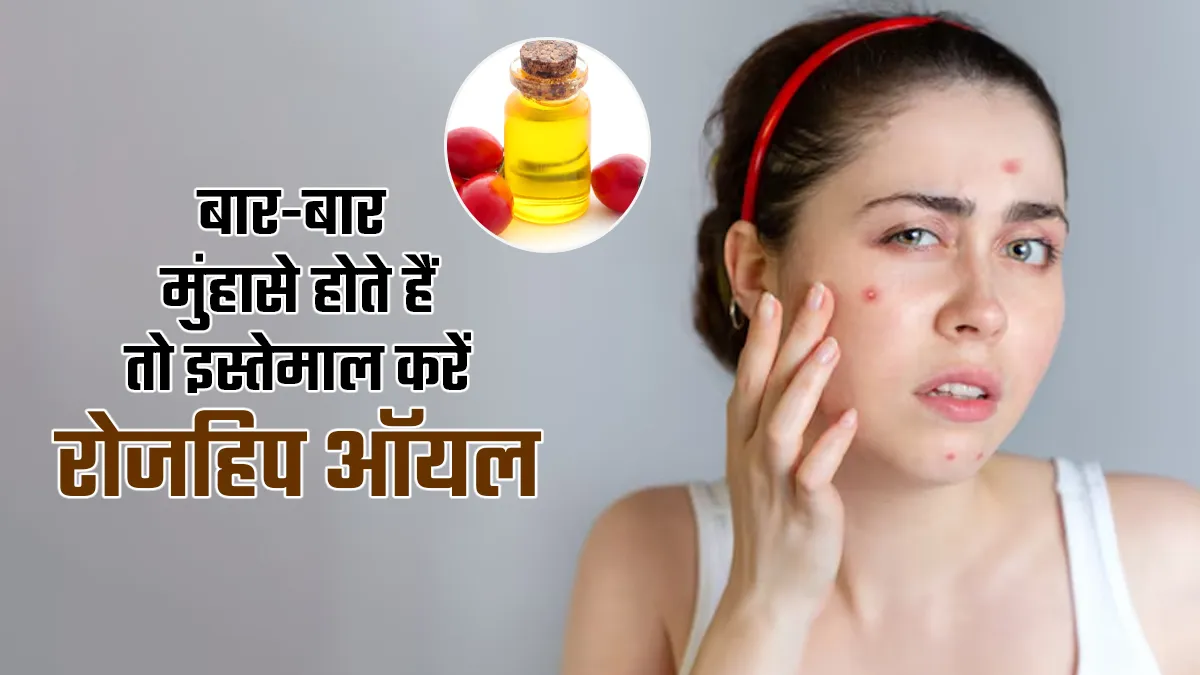 बार-बार मुंहासे होते हैं तो इस्तेमाल करें रोजहिप ऑयल, एक्सपर्ट से जानें फायदे