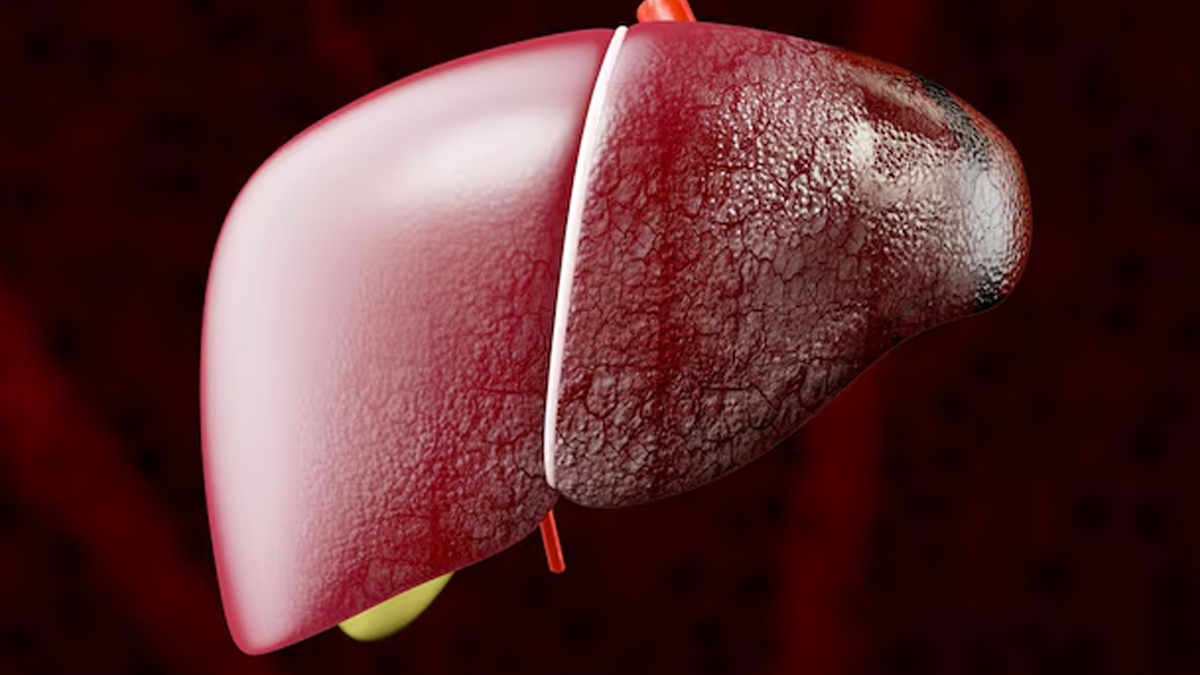habits that damage your liver in hindi 01 (3)