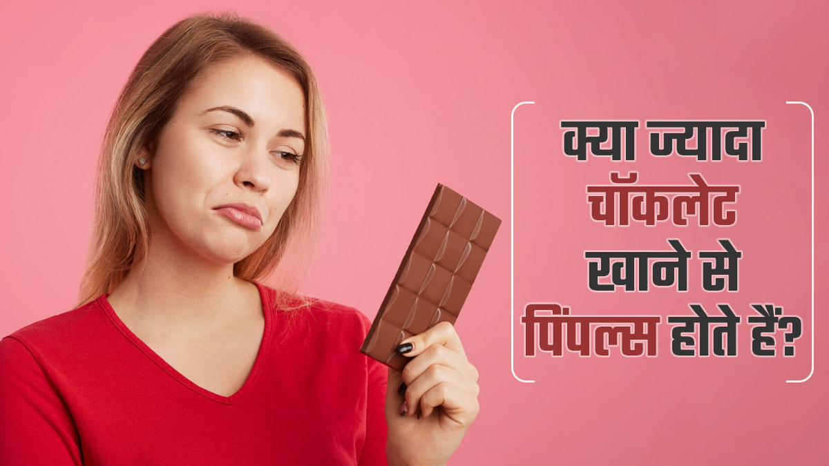 क्या ज्यादा चॉकलेट खाने से पिंपल्स होते हैं? जानें एक्सपर्ट से