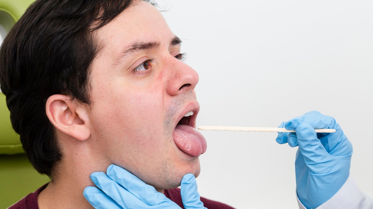 outh ulcers or cancer know the difference