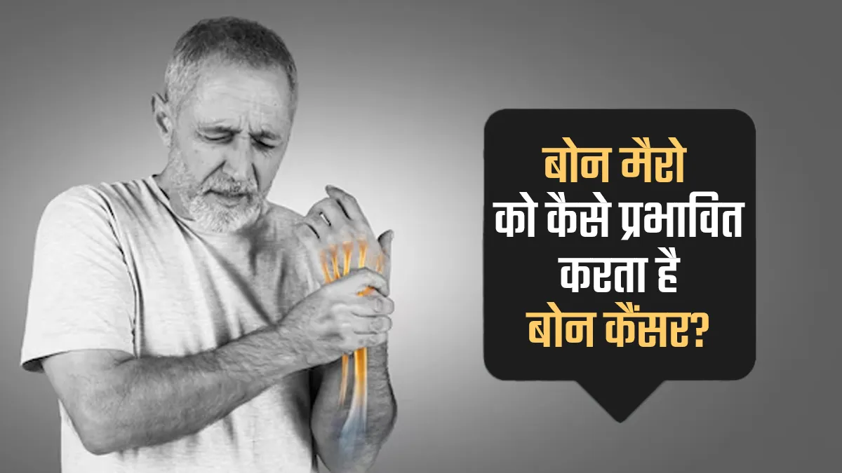 बोन मैरो को कैसे प्रभावित करता है बोन कैंसर? जानें डॉक्टर से