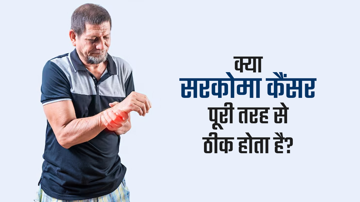 क्या सरकोमा कैंसर पूरी तरह से ठीक होता है? जानें डॉक्टर से