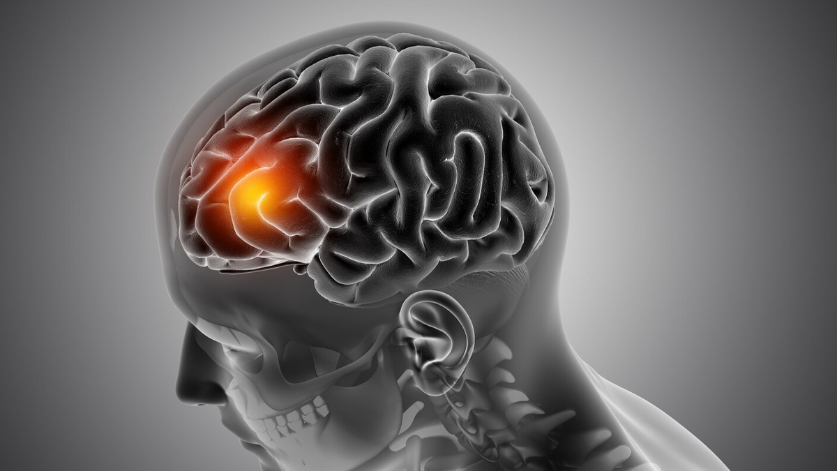 does air pollution increase the risk of brain tumor in hindi 01 (3)