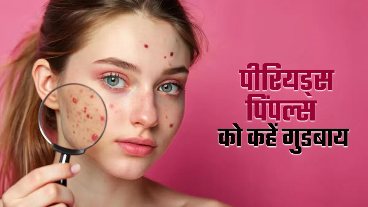 हर महीने पीरियड्स के साथ पिंपल्स की टेंशन? अब नहीं, इन 10 उपायों से पाएं राहत
