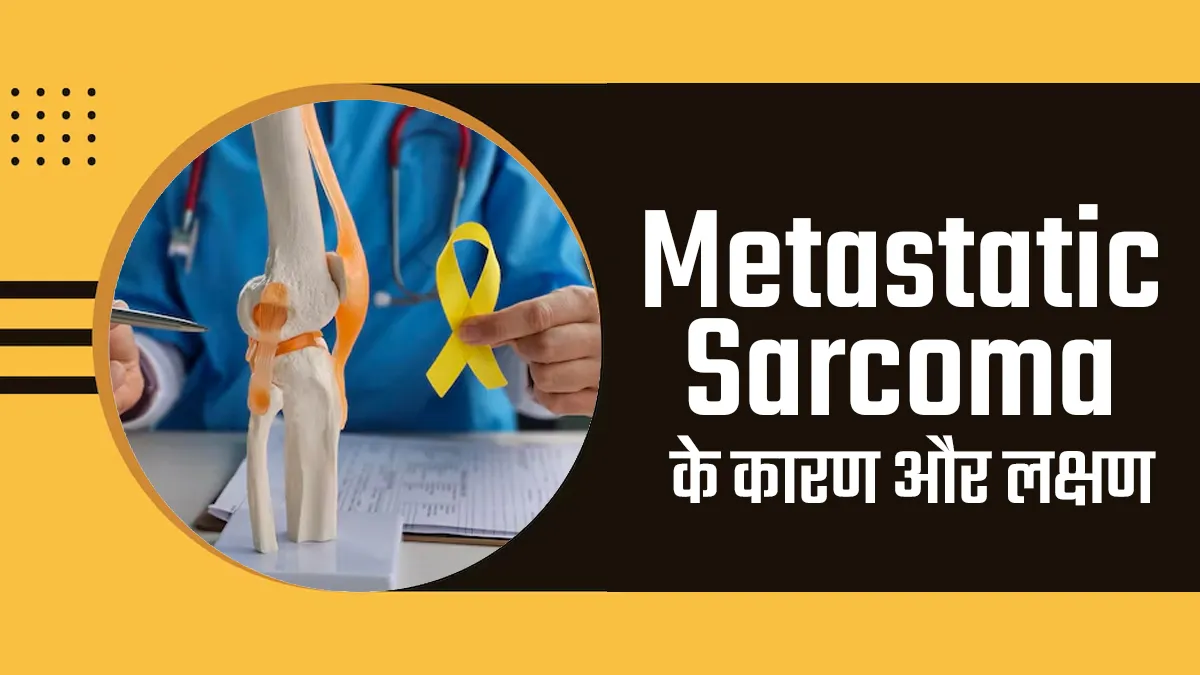 Bone Cancer Awareness Month: मेटास्टेटिक सारकोमा क्या है? डॉक्टर से जानें क्या है इसके कारण और लक्षण
