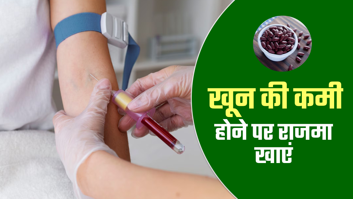 आयरन से भरपूर है राजमा, खून की कमी होने डाइट में जरूर करें शामिल